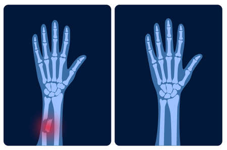 Role of Meditation in Cardiac Rehab: A Scientific Review of Indian Meditation Techniques
